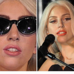 Lady Gaga se opera la nariz(Mira las fotos)