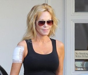 melanie-griffith-borra-tatuaje-644x550